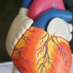 Kardiomyopathie