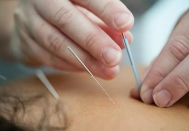Studie: Wirkung von Akupunktur bei Karpaltunnelsyndrom