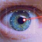 Augenerkrankung: Was ist ein Okulares Histoplasmose-Syndrom?