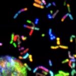 Wissenschaftler entdecken neues Ziel für Parkinson-Behandlung