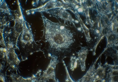 Künstliche Nervenzellen - fast wie biologische