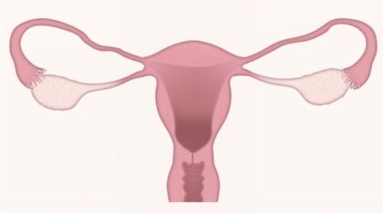 Forschung: Unregelmäßige Menstruationszyklen und welche Gesundheitsrisiken damit verbunden sind