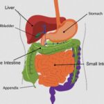 Morbus Crohn - Symptome, Diagnose, Behandlung, Ernährung