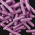 Tuberkulose mit erhöhtem Krebsrisiko verbunden