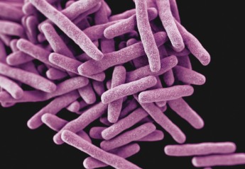 Tuberkulose mit erhöhtem Krebsrisiko verbunden