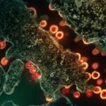 Bakterien zerstören Krebszellen gezielt im Tumor