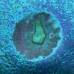 Dieser Beitrag beschäftigt sich mit einem medizinischen Thema, einem Gesundheitsthema oder einem oder mehreren Krankheitsbildern. Dieser Artikel dient nicht der Selbst-Diagnose und ersetzt auch keine Diagnose durch einen Arzt oder Facharzt. Bitte lesen und beachten Sie hier auch den Hinweis zu Gesundheitsthemen!